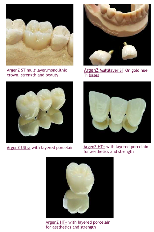 , Crowns and Bridges
