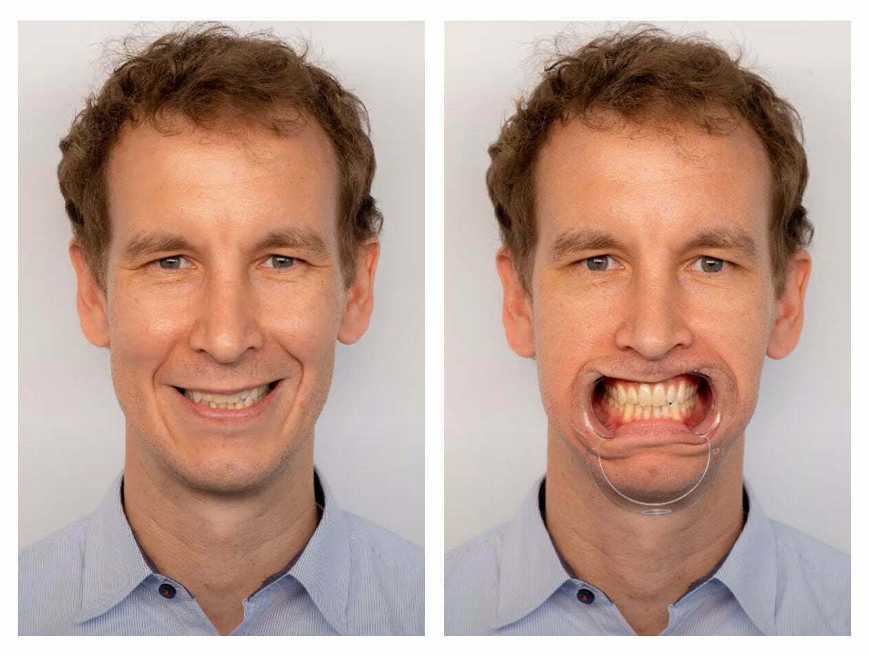 , Digital Smile Design