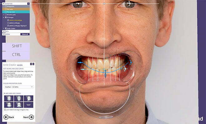 , Digital Smile Design