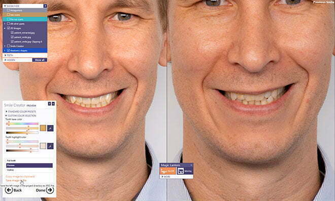 , Digital Smile Design