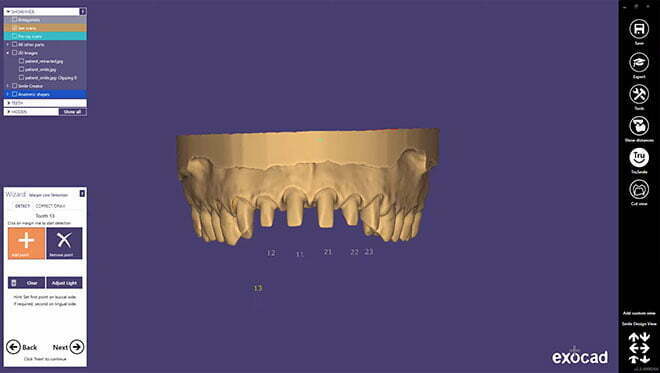 , Digital Smile Design