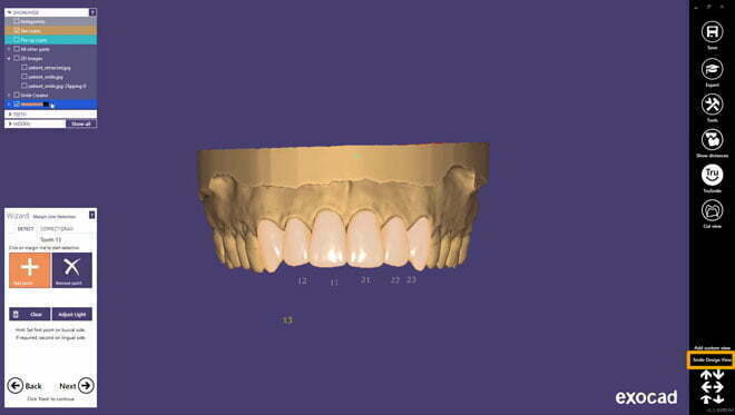 , Digital Smile Design