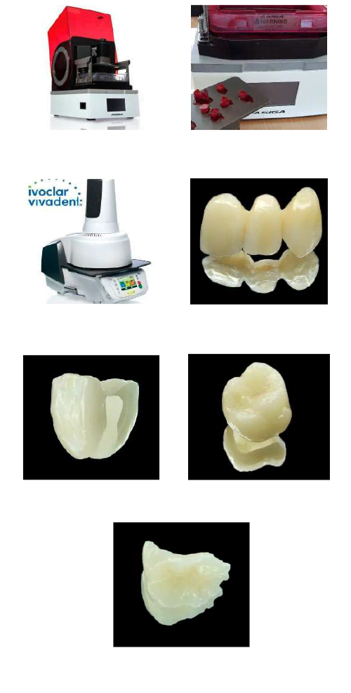 , Crowns and Bridges